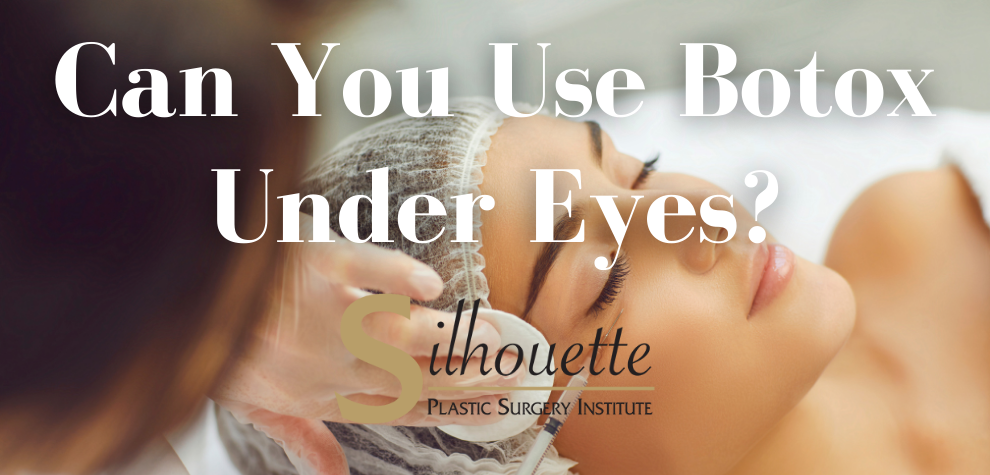 botox under eyes