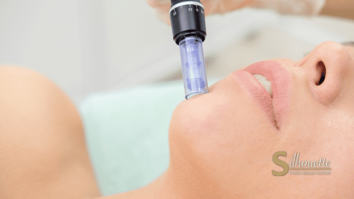 blood facial bakersfield