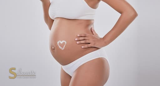 stretch marks removal