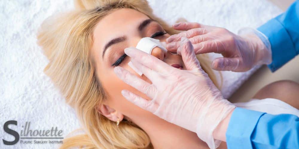 rhinoplasty recovery timeline