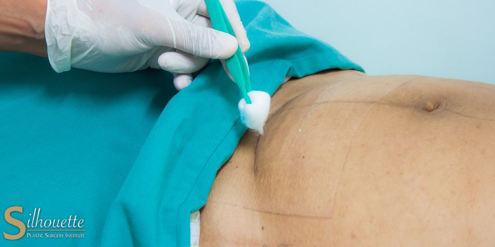 c section shelf removal