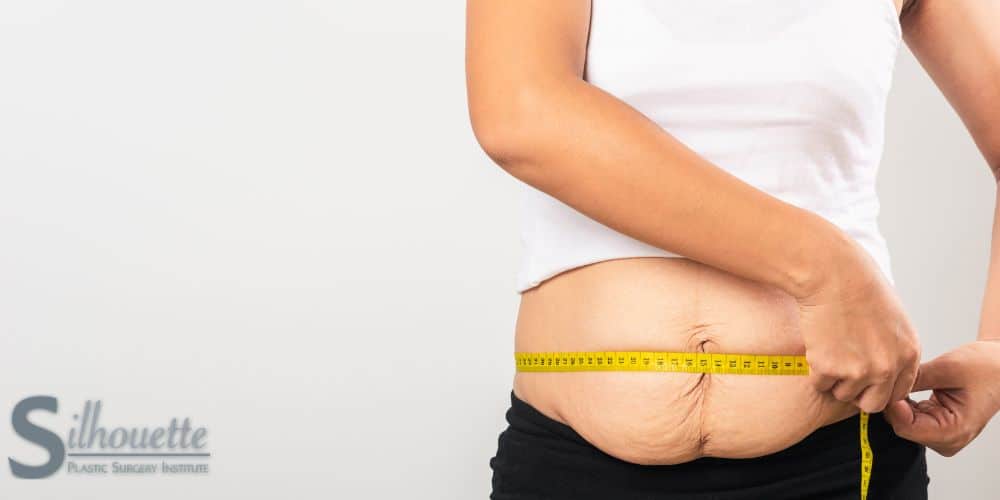 how to get rid of c section pouch