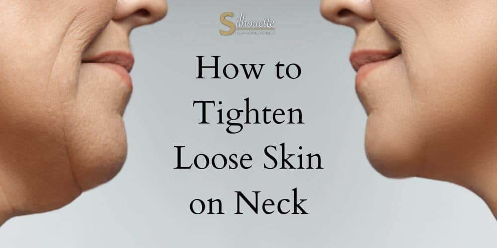 Neck Tightening in Orange County and Bakersfield