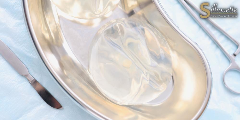 squamous cell carcinoma of the breast