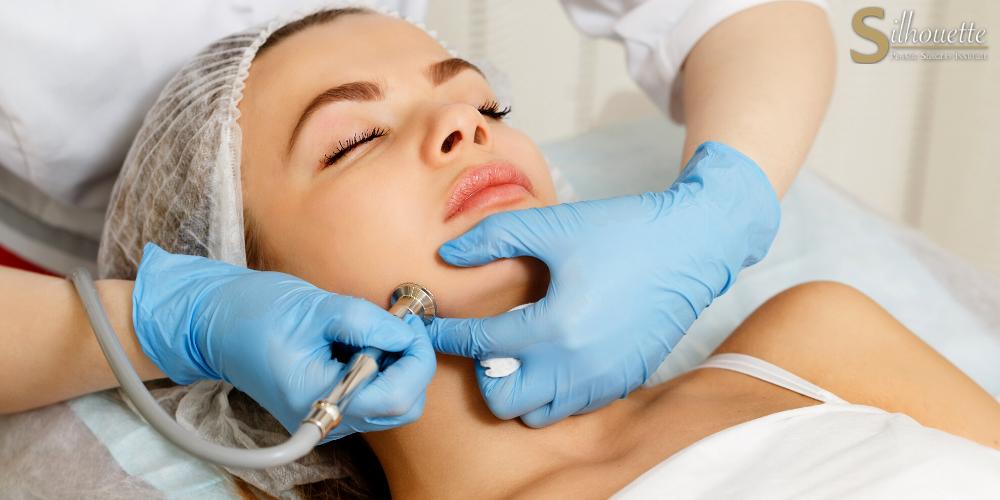 acne scars treatment