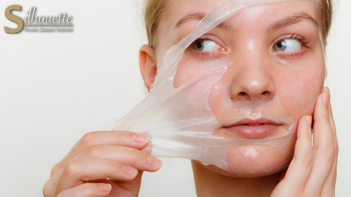 chemical peel phenol