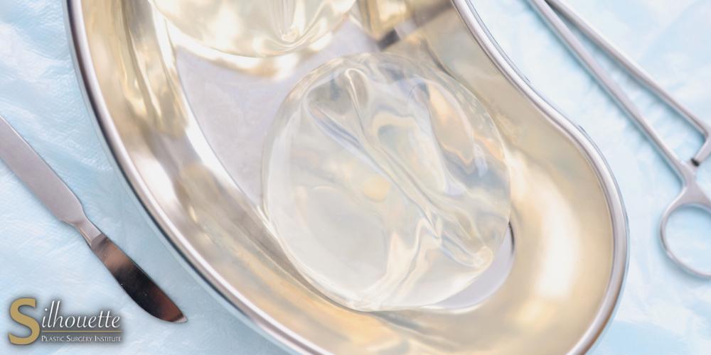 silicone implant rippling