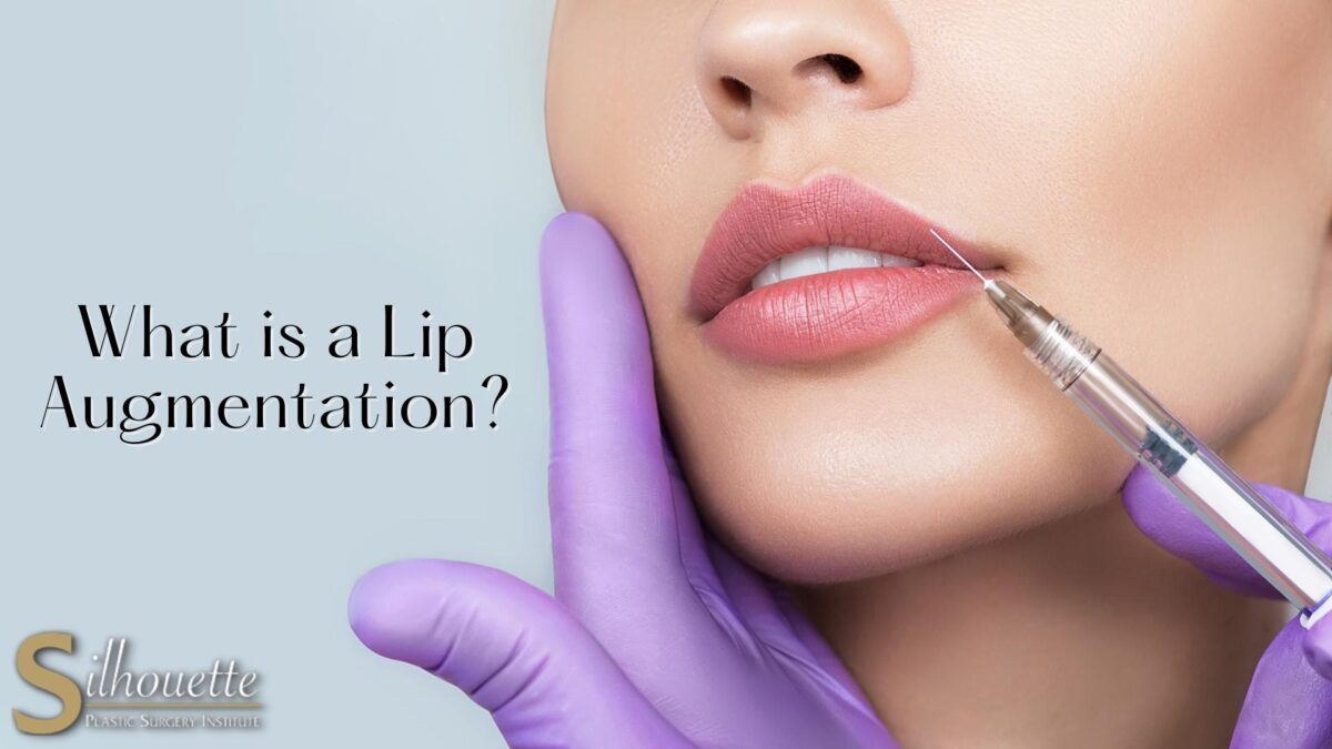 lip augmentation