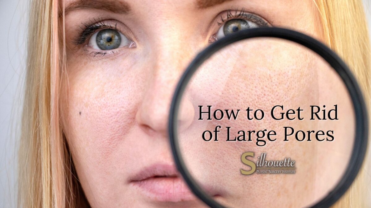 how to get rid of large pores