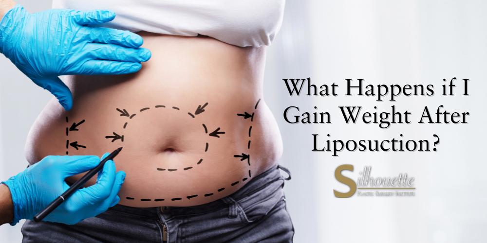 gain weight after liposuction