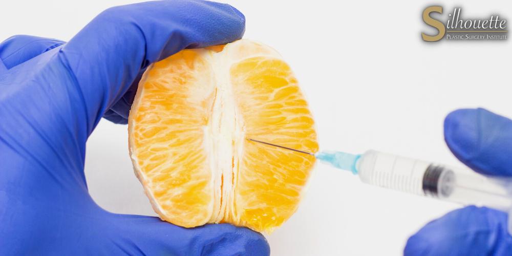 what is labiaplasty surgery