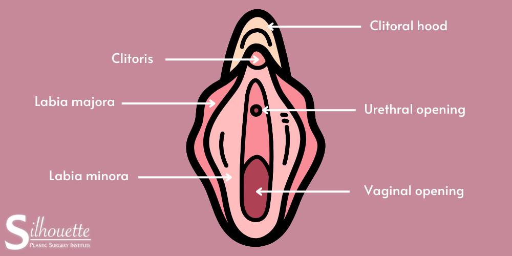 what is a labiaplasty