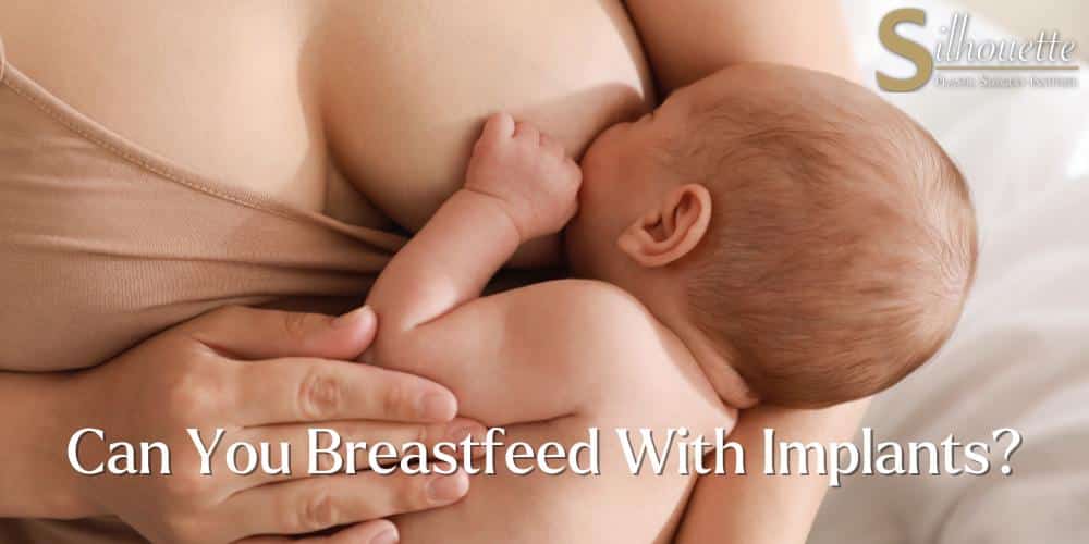 can you breastfeed with implants