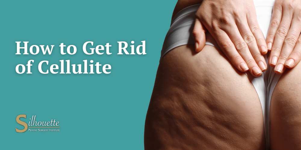 How to Get Rid of Cellulite