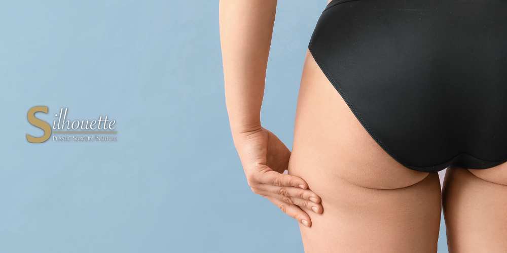 how to get rid of cellulite on butt